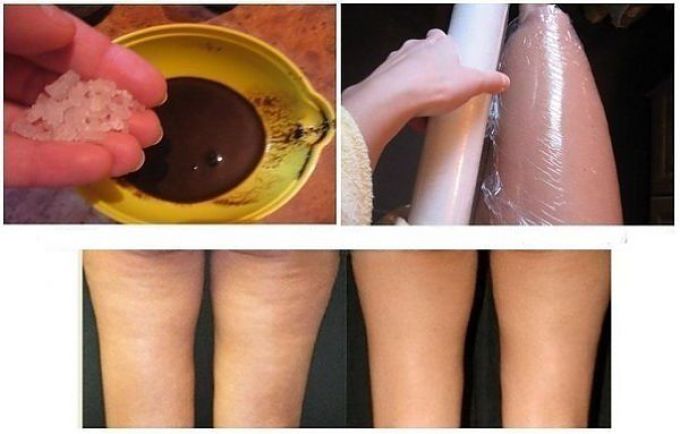 Scrub and wrap procedure to get rid of cellulite